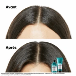 Duo Anti-Inconfort Scalp Advanced L'Oréal -Produits Coiffure Soldes 3474637090487 4 62822.1759479645